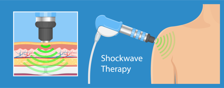 Shockwave therapy illustration of how the head penetrates the skin to promote healing