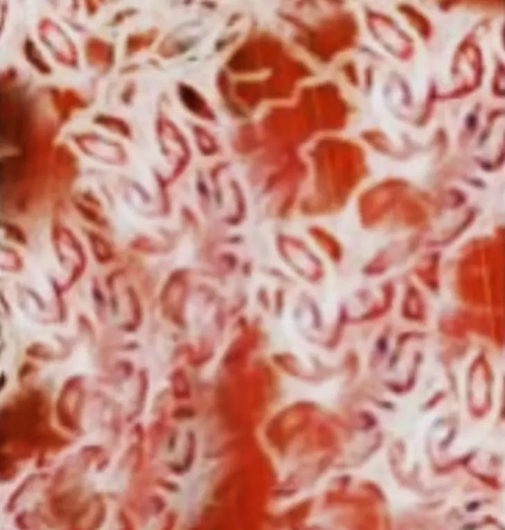 Illustration showing unhealthy human tissue that has crystallized