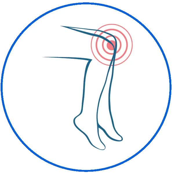 Illustration of legs from thigh to feet showing a bullseye on knees indicating pain