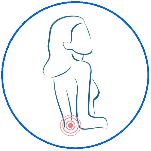 Illustration of woman's back showing a bullseye on lower back indicating pain