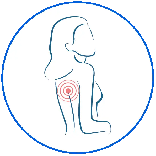 Illustration of woman's back showing a bullseye on upper back indicating pain